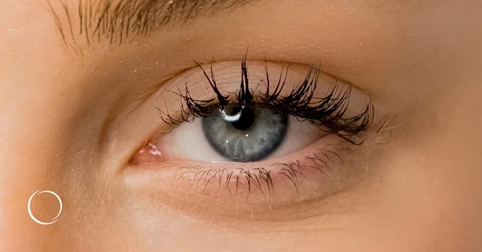 the ins and outs of canthopexy and canthoplasty